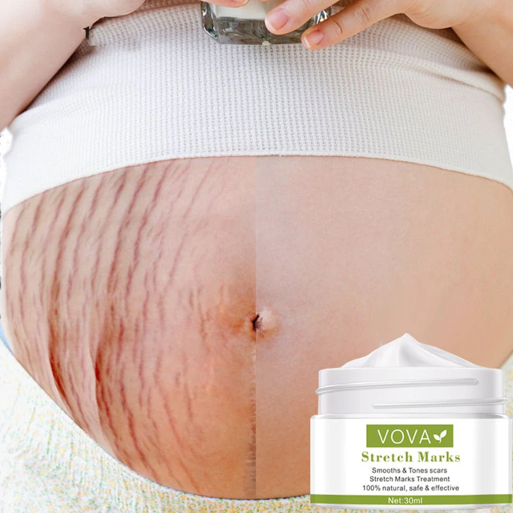 Anti-Stretch Marks Scar Removal Cream